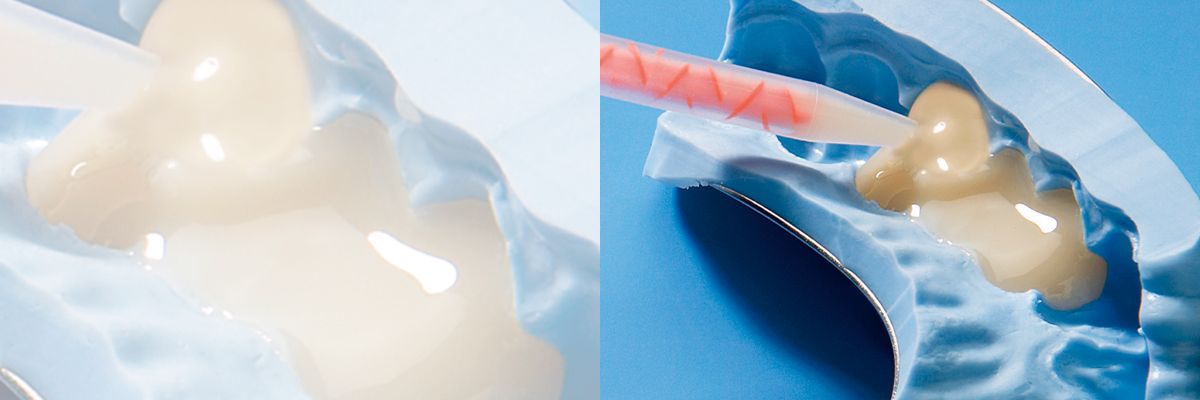 Bienestar biológico, funcional y estético en paciente con lesiones cervicales no cariosas mediante restauraciones cerámicas