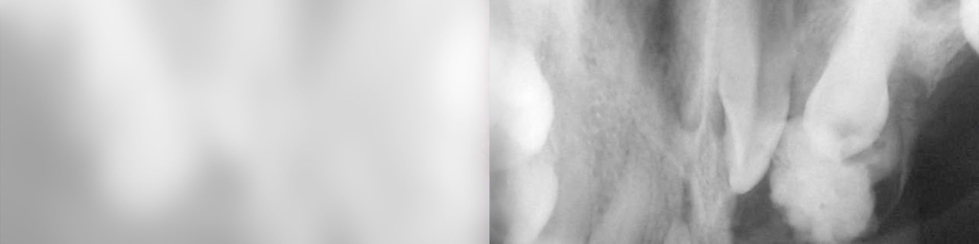 Tumores odontogénicos, un desafío diagnóstico digno de afrontar