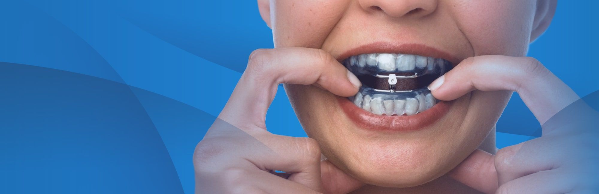 Ortodoncia y Apnea del Sueño: ¿Cómo puede ayudarte Orthoapnea?