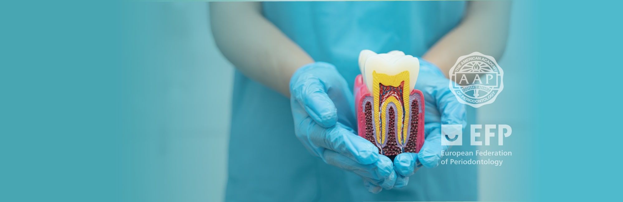 Nueva clasificación de enfermedades periodontales