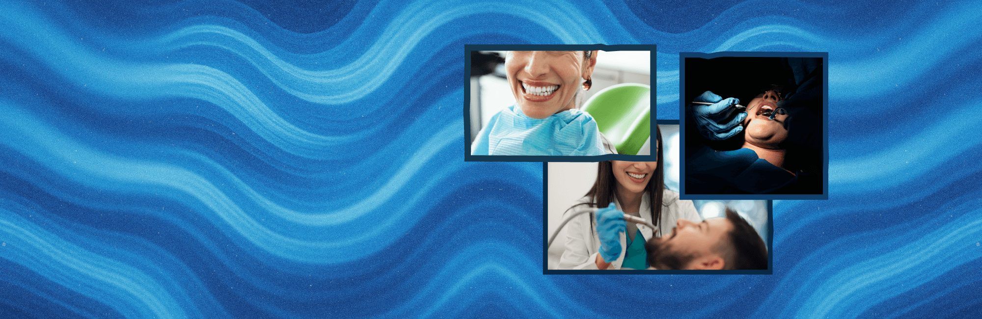 Reconstrucción posendodóntica, protocolo biomimético con restauración indirecta de resina nano híbrida