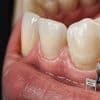 Cuidado dental