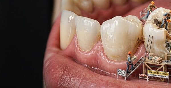 Cuidado dental